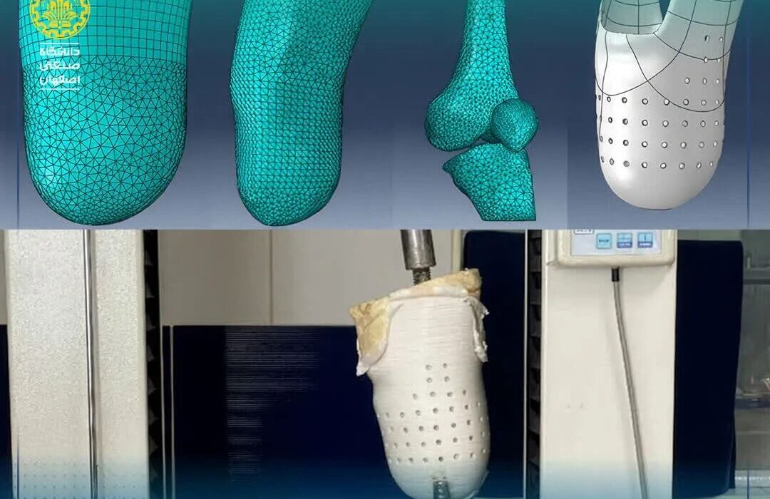 ساخت سوکت سه‌بعدی بومی برای بیماران قطع عضو در دانشگاه صنعتی اصفهان