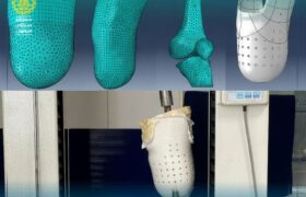 ساخت سوکت سه‌بعدی بومی برای بیماران قطع عضو در دانشگاه صنعتی اصفهان