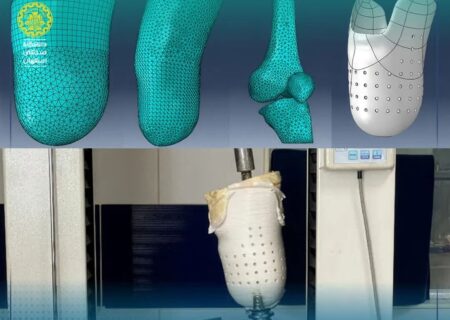 ساخت سوکت سه‌بعدی بومی برای بیماران قطع عضو در دانشگاه صنعتی اصفهان